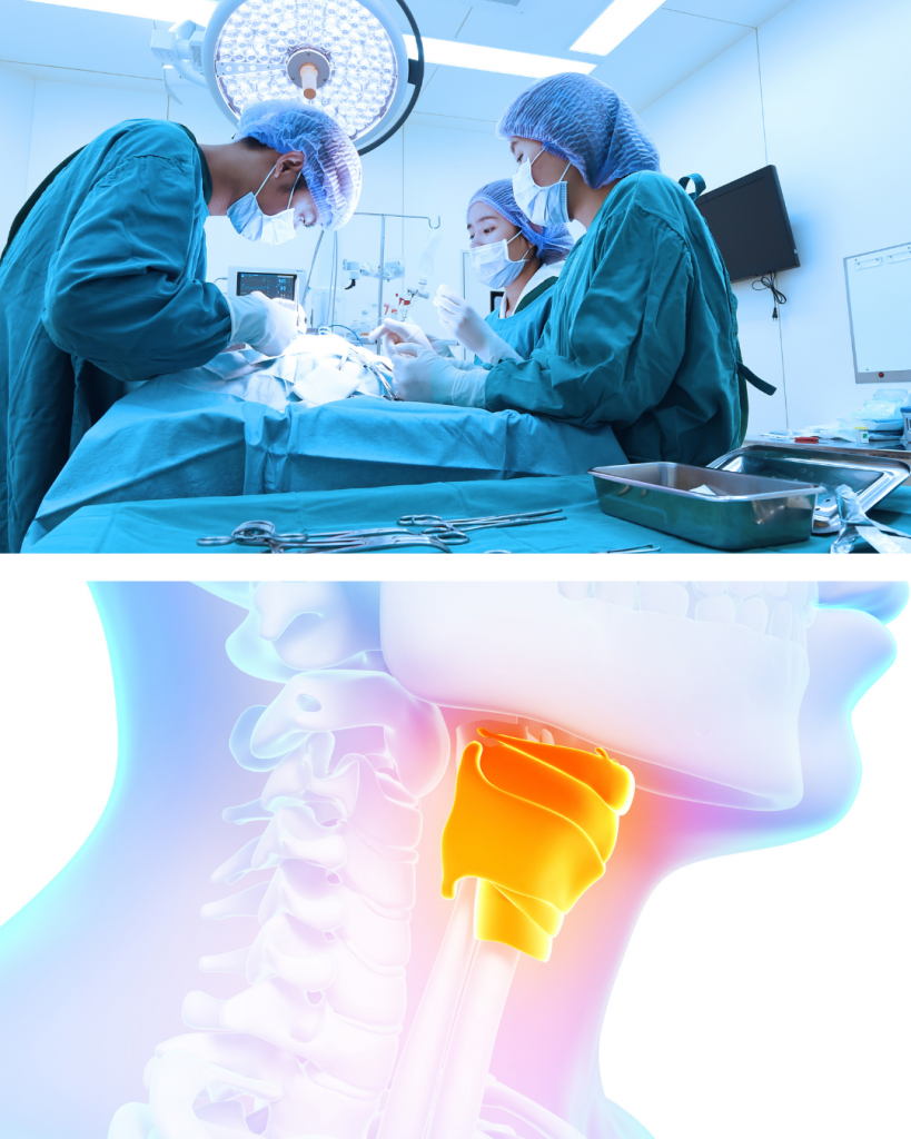 Glotoplastia Feminización de la voz